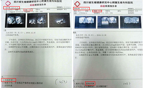 成都治疗不孕不育的医院