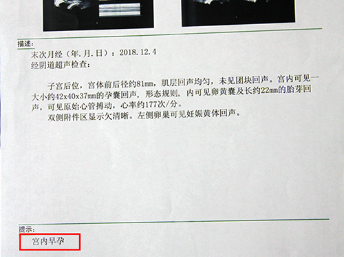 成都治疗不孕的专业医院