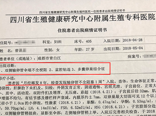四川多囊卵巢综合征不孕不育